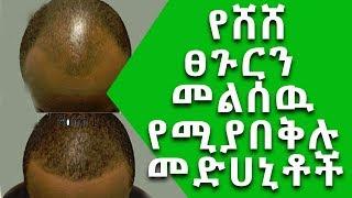 Ethiopia፡ የሸሸ ፀጉርን መልሰው የሚያበቅሉ ምትሀተኛ መድሀኒቶች