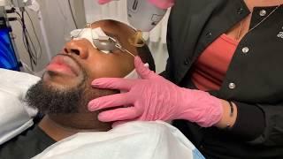 Gentlemax Pro Laser Facial | YAG 1064 Wavelength | New York, NY | Dr. Jason Ener x SAFAREE