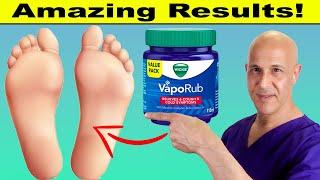 Rub VICKS VapoRub on Your Feet and Toes and Discover What Happens Next!  Dr. Mandell