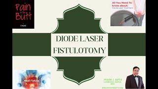 DIODE LASER FISTULOTOMY