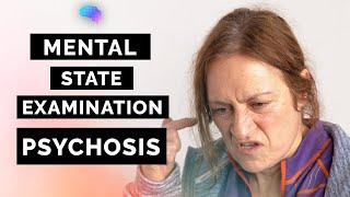 Psychosis (Schizophrenia) | Mental State Examination (MSE) | OSCE Guide |  SCA Case | UKMLA | CPSA