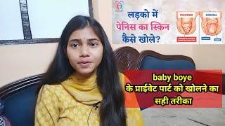 how to open baby boy private part!!बेबी बॉय का सुसु कैसे खोले!बेबी बॉय का प्राइवेट पार्ट कैसे खोले