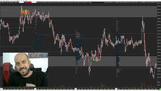 Worum es im Trading wirklich geht️