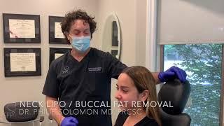 Neck Liposuction + Buccal Fat Removal Surgery | 1 Week Before & After Results | Dr. Philip Solomon