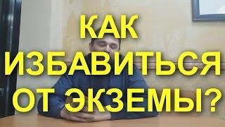 #ЭКЗЕМА НА РУКАХ? ЗНАЕМ КАК ВЫЛЕЧИТЬ ЭКЗЕМУ!