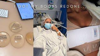 I GOT MY BOOBS DONE... AGAIN | Breast Revision Surgery Vlog/Experience + 2 week update