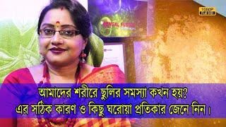 আমাদের শরীরে ছুলির সমস্যা কখন হয়? এর সঠিক কারণ এবং ঘরোয়া প্রতিকার জেনে নিন। | EP 967