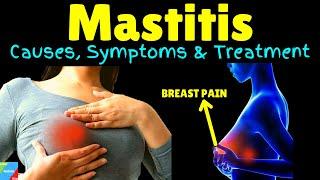 Mastitis | Breast Infection - Symptoms, Causes, Treatment, Prevention