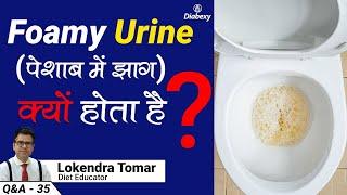 What are the Reasons of Foamy Urine Among Diabetic Patients | Diabexy Q&A 35
