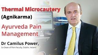 Thermal Microcautery (Agnikarma): Ayurveda Pain Management | Dr Camilus Power, Ireland