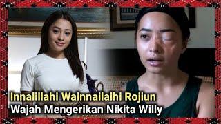 Jarang Tampil Di TV, Nikita Willy Ternyata Dr0p Dengan Penampilan Mengerik4n