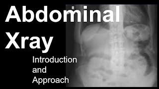 Abdominal Xray: Introduction and Approach
