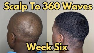 Scalp to 360 Waves - Week 6