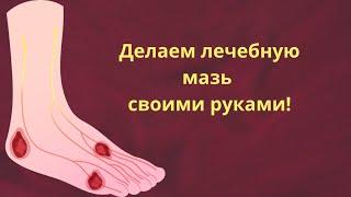 ПРОСТО ЛУЧШЕ! Смесь для заживления кожи при варикозе и трофических язвах