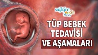 Tüp Bebek Tedavisi ve Aşamaları