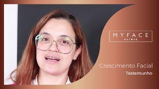 MyFace Clinic - Testemunho