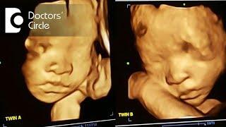 When is the best time to have 3D 4D ultrasound with twins?-Dr. Shoba Venkat of Cloudnine Hospitals