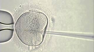 ICSI - Intracytoplasmic sperm injection