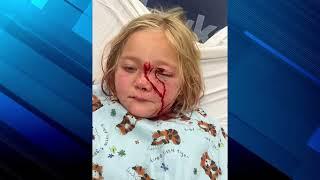 MI: Boy saves 6 year old sister from dog attack