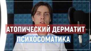 Атопический дерматит, психосоматика у детей и взрослых. Новая Германская Медицина. ГНМ.