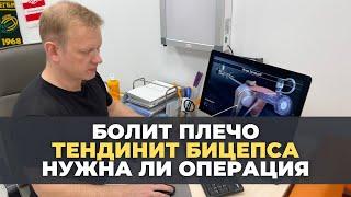 Тендинит бицепса. Почему болит плечо? Когда нужна операция?