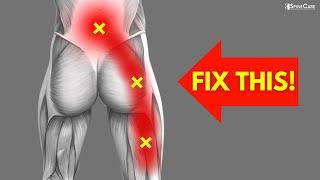 How to INSTANTLY Fix Pinched Nerve Pain in the Back and Leg