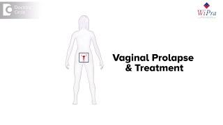 Vaginal Prolapse :Treatment - Dr. Sahana K P