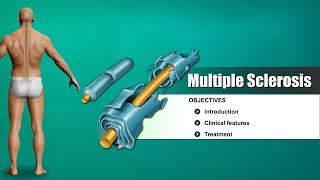 Multiple sclerosis - causes, symptoms, diagnosis, treatment, pathology