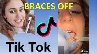 Orthodontist Reacts to Braces Off Tik Tok's! (V)