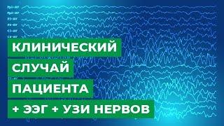 Клинический случай пациента + ЭЭГ + УЗИ нервов