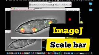 Scale bar not showing up in TIFF image | ImageJ scale bar disappears | set scale bar in ImageJ