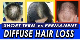 Permanent vs Temporary Diffuse Hair Loss and Telogen Effluvium. How to differentiate?