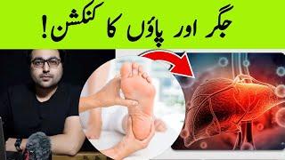 Dr. Zee:How Your Feet Are Warning You About Your Liver Problems | जिगर और पैर का कनेक्शन