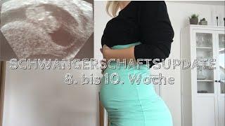 Schwangerschaftsupdate 8. bis 10. Woche | Blutungen - Notaufnahme | 1. + 2. Frauenarzttermin