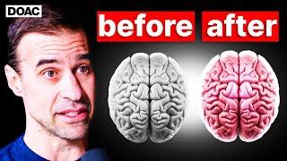 The BEST Type of Exercise To HEAL Your BRAIN! | The Brain Professor
