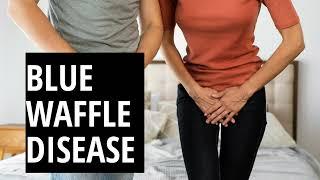 Blue Waffle Disease | Is It a Real STI or a Myth?