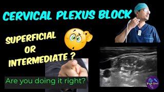 SUPERFICIAL CERVICAL PLEXUS BLOCK  ULTRASOUND-GUIDED  LANDMARK & LOR  TIPS & TRICKS