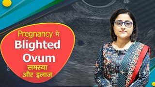 Blighted ovum / anembryonic pregnancy / failed pregnancy. सोनोग्राफी में बच्चे की धड़कन का नहीं आना