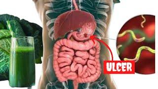 Fast and Easy Way To Heal An Ulcer With Cabbage Juice