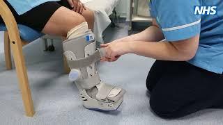 Splints: Airstep walking boot