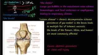 #62P - Air Embolism, decompression sickness, the bends, the chokes, cassion disease