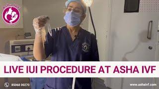 Live IUI Procedure at ASHA IVF | Step-by-Step Process