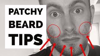 3 Tips on How to Deal with a Patchy Beard with Beardster