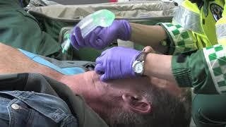 Igel Insertion