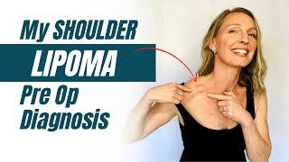 My Shoulder Lipoma Diagnosis: Pre Op Story