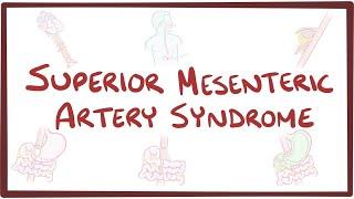 Superior mesenteric artery syndrome - an Osmosis Preview