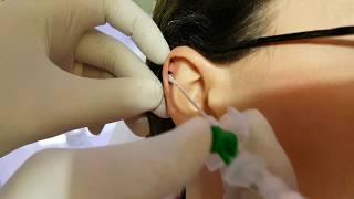 Kıkırdak Helix Piercing Delimi Acı Oranı ??