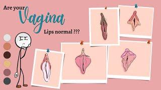 Are your vaginal lips normal | know your BODY