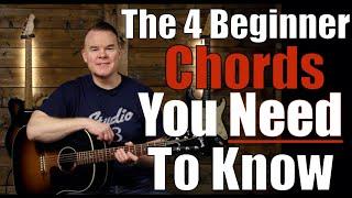 Beginner Guitar Chords, Learn These First! (must know chords!)