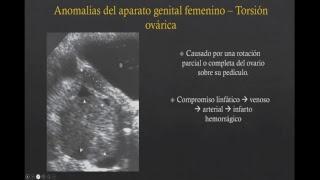 Patología del sistema genitourinario en pediatría Dr. Ulises Longoria